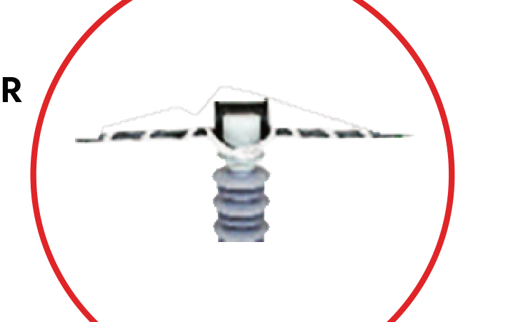 MVCC anchoring clamp